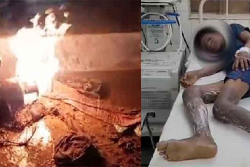 राजस्थान&अलवर में गैस सिलेंडर में लीकेज से झुलसा किशोर, चाय बनाकर गैस बंद करते समय हादसा