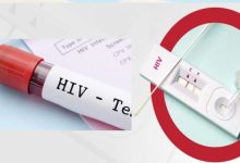 मेघालय राज्य में HIV टेस्ट कराए बिना नहीं होगी शादी, सरकार की बड़ी तैयारी