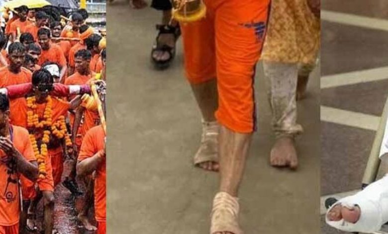 कांवड़ यात्रा के बाद 110 किमी पैदल चलने से सांसद के पैरों में समस्या, व्हीलचेयर से संसद पहुंचने पर चिंता कांवड़ यात्रा के बाद 110 किमी पैदल चलने से सांसद के पैरों में समस्या, व्हीलचेयर से संसद पहुंचने पर चिंता